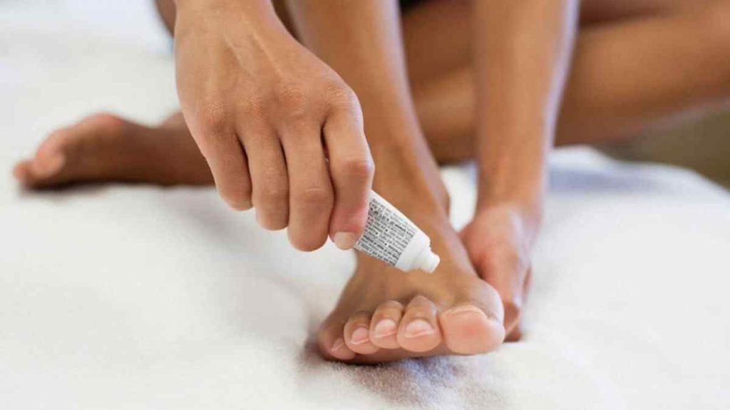 antifungal for nails